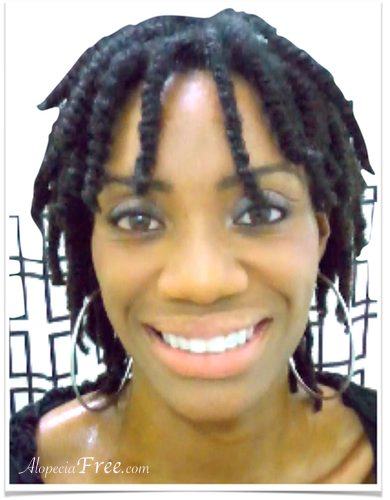 How I Cured My Alopecia Naturally How I Cured My Alopecia Naturally
